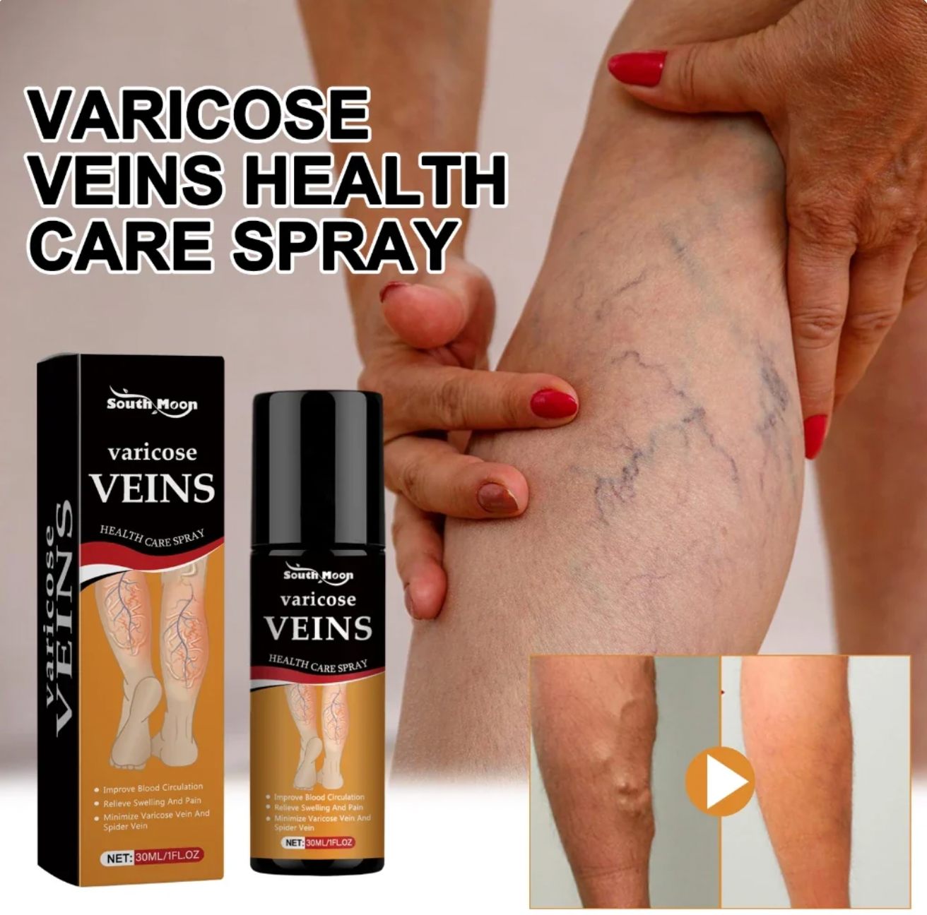 Turmeric Varicose Vein Relief Spray (BUY 1 GET 2 FREE 😍)