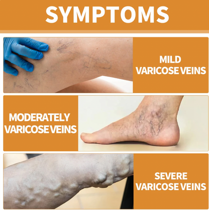 Turmeric Varicose Vein Relief Spray (BUY 1 GET 2 FREE 😍)